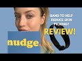 NUDGE BAND REVIEW 😃🧐 A DEVICE TO HELP REDUCE SKIN PICKING?!