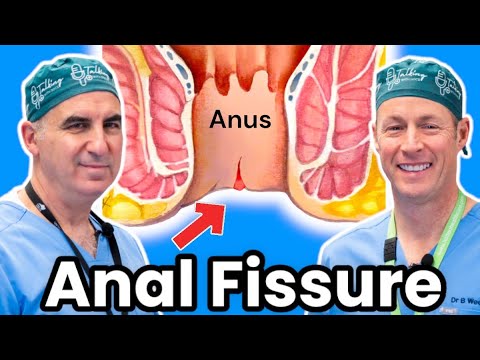How To Get Rid Of Anal Fissures