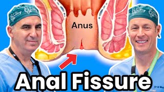 How To Get Rid Of Anal Fissures