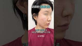 고용량 리쥬란 엠보!