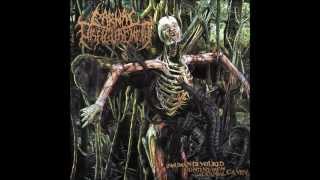 Carnal Disfigurement-Inhuman Devoured Content from Cranial Cavity ( full album )