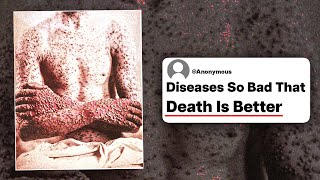 What Diseases Are So Bad That Even Doctors Say Death Would Be Better?