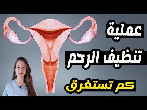 كم تستغرق عملية تنظيف الرحم؟