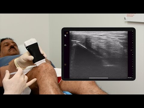 Intra articular Knee Joint Cortisone Injection