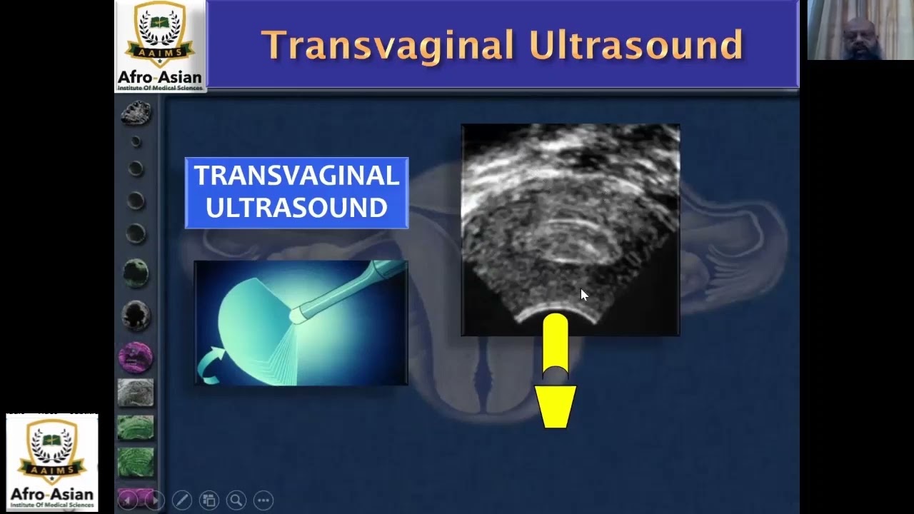 Introduction to Transvaginal Ultrasound