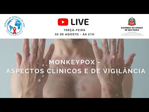 LIVE ÀS TERÇAS: Monkeypox – Aspectos Clínicos e de Vigilância