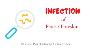 Infection of Penis and Foreskin