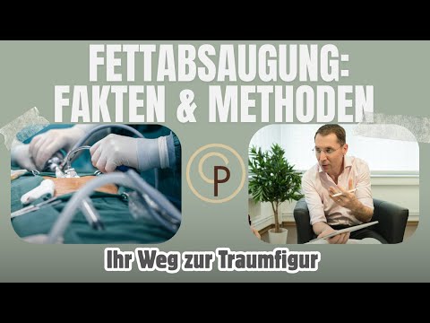 Fettabsaugung: Alles über Methoden, Risiken & Ergebnisse!