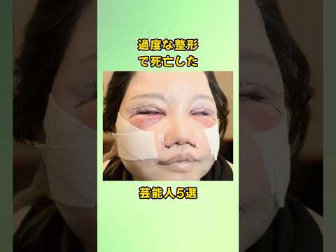 過度な整形で死亡した芸能人5選#shorts
