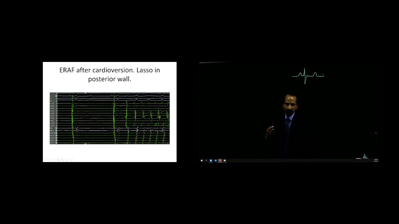 Heart Rhythm Webinar Series
