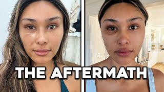 Everything That Went WRONG During My Eye Surgery