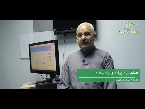 Glaucoma Patient Story 15
