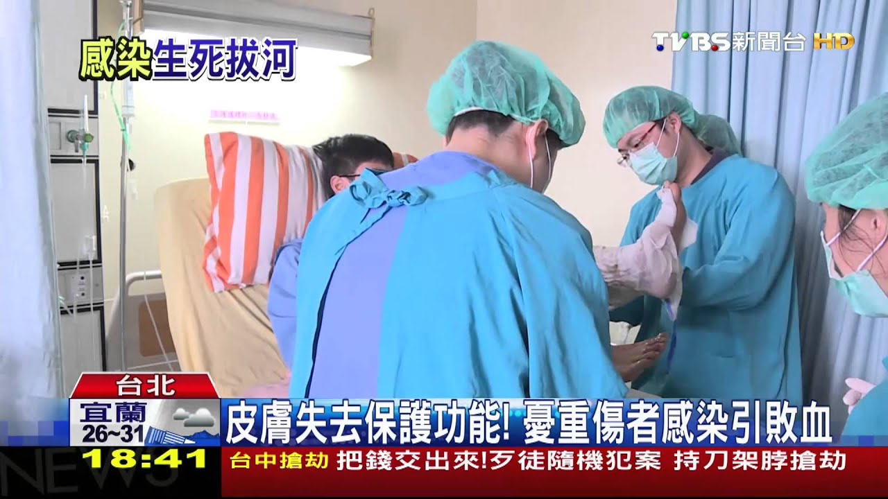 塵爆重傷關鍵第3週! 憂感染引發器官衰竭