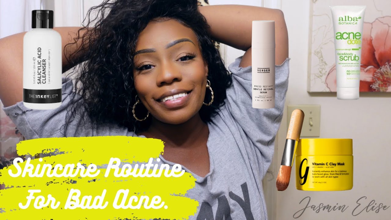 SKINCARE ROUTINE FOR ACNE PRONE SKIN