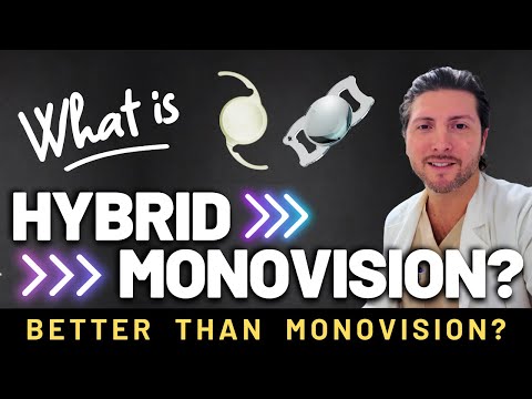 Is Hybrid Monovision better than traditional Monovision? | Patient Interview