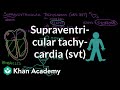 Supraventricular tachycardia (SVT) | Circulatory System and Disease | NCLEX-RN | Khan Academy