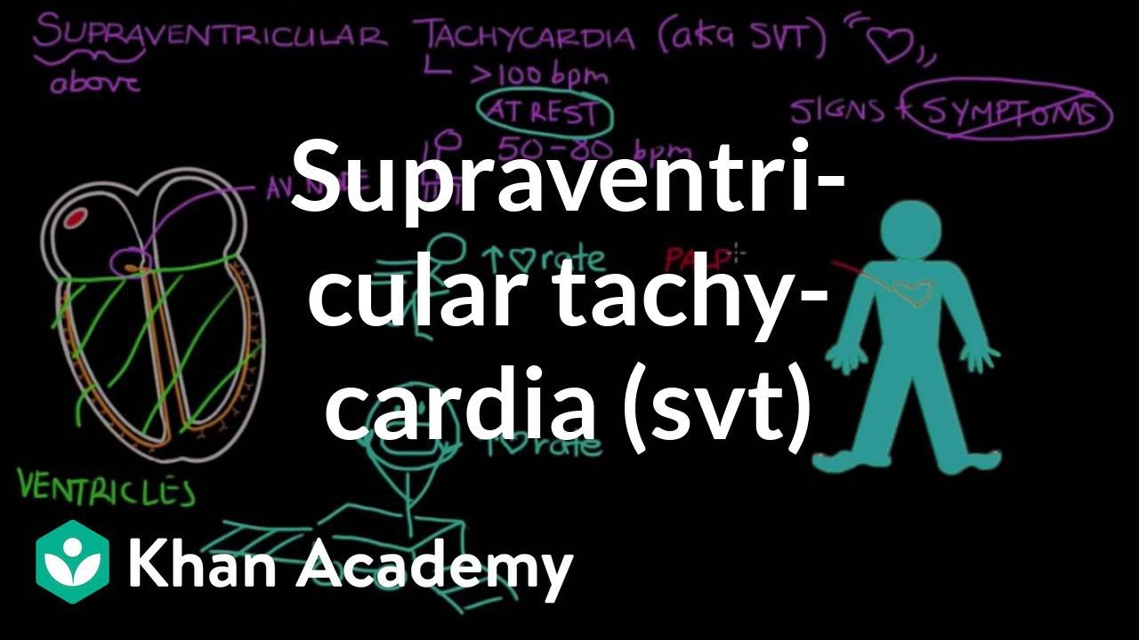 Supraventricular tachycardia (SVT) | Circulatory System and Disease | NCLEX-RN | Khan Academy
