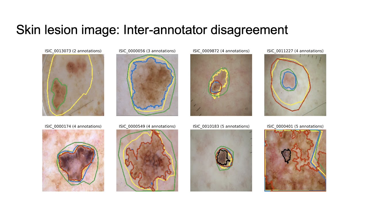 D-LEMA: Deep Learning Ensembles from Multiple Annotations