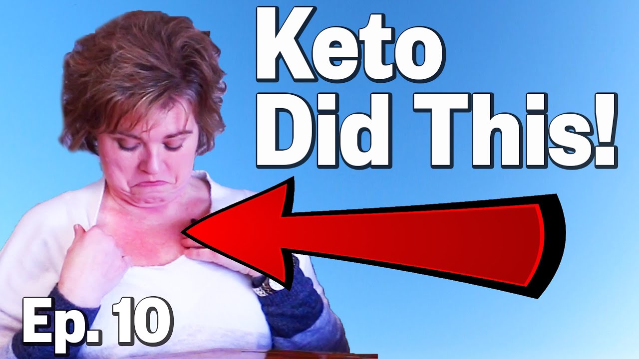 Keto and Fasting, the good the bad & the itchy.