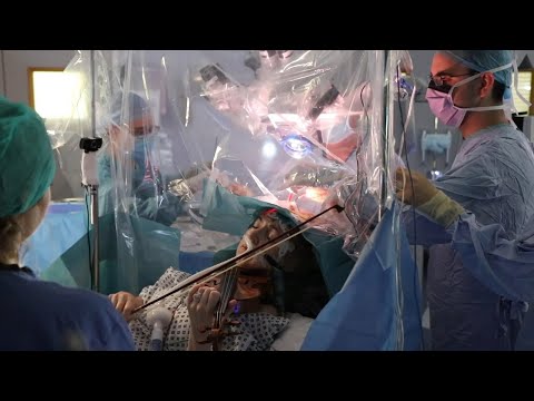Ασθενής παίζει βιολί ενώ χειρουργείται στον εγκέφαλο