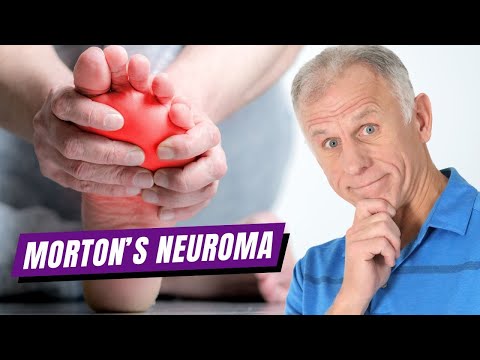 Fastest Way to Heal Morton’s Neuroma at Home