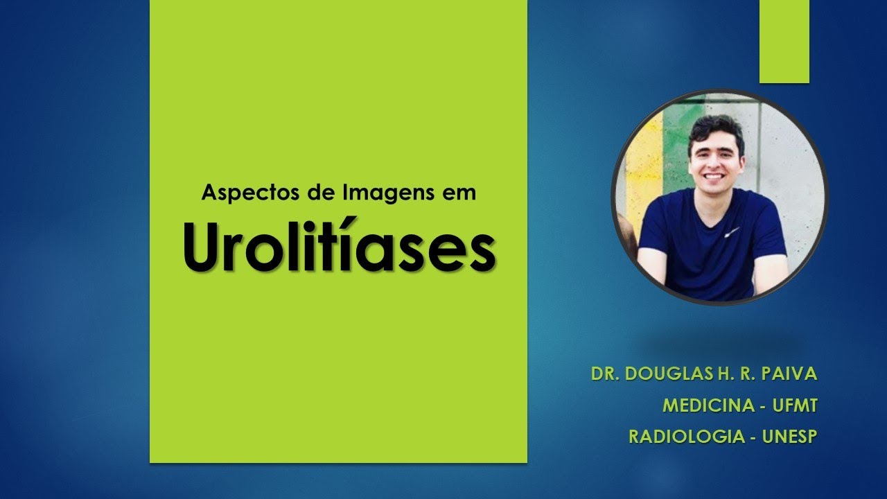 Aspectos de Imagens em Urolitíase