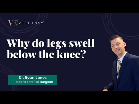 What causes swollen legs from the knee down?