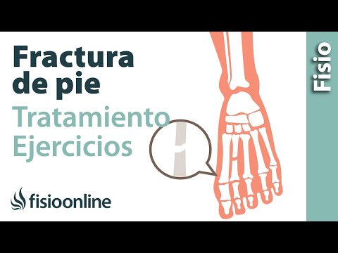 I metodi tradizionali per dolori articolari Complicazioni di artrite reumatoide delle articolazioni