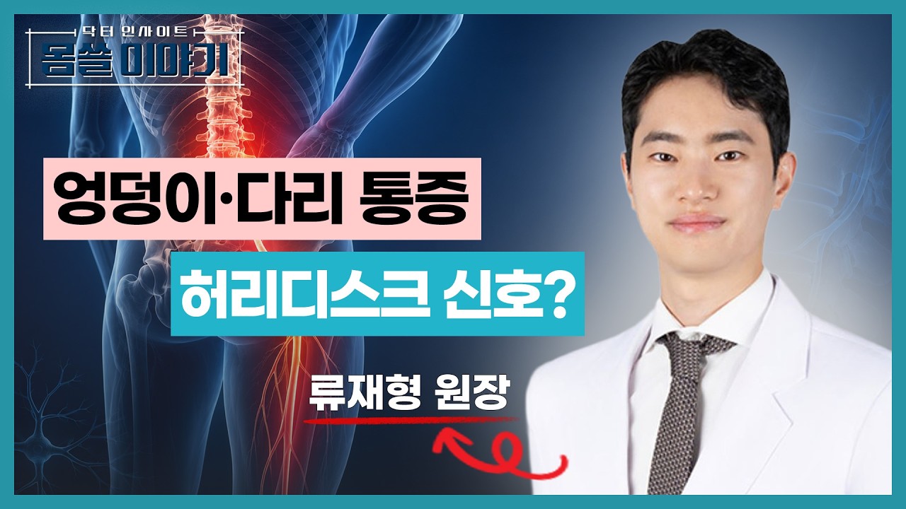 허리만 아픈 게 아닙니다! 다리 저림·엉덩이 통증 '방사통'의 진짜 원인 [몸쓸이야기 26회]
