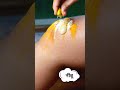 Make Dark Knees And Elbows Fair Skin Whitening Beautyreels Skincare Beauty Reels