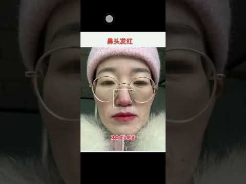 面相氣色