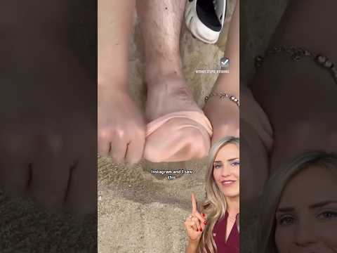 Doctor reacts: socks on the beach?