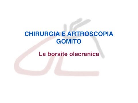 Come acquistare un corsetto da osteocondrosi Esercizi per larticolazione del ginocchio