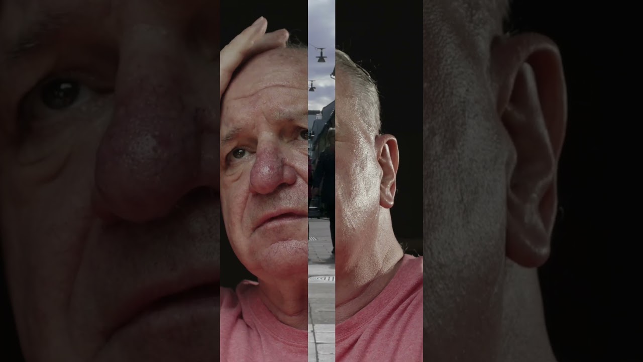 Do you know about Alzheimer’s Disease