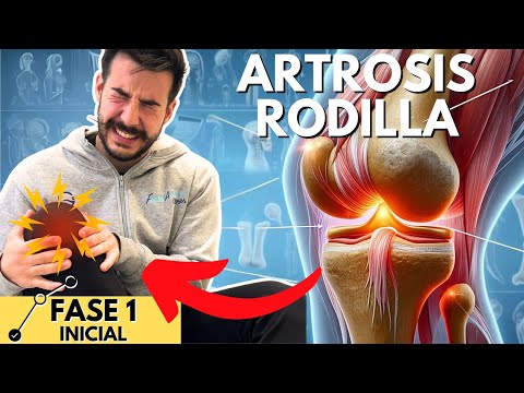 5 Exercises to IMPROVE OSTEOARTHRITIS and WEAR AND TEAR of your KNEES [PHASE 1] 🦵🏼💥