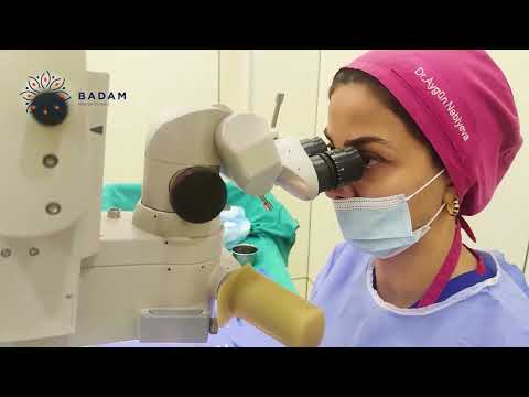 Cərrah - Oftalmoloq Dr.Aygün Nəbiyeva - Katarakta əməliyyatı.