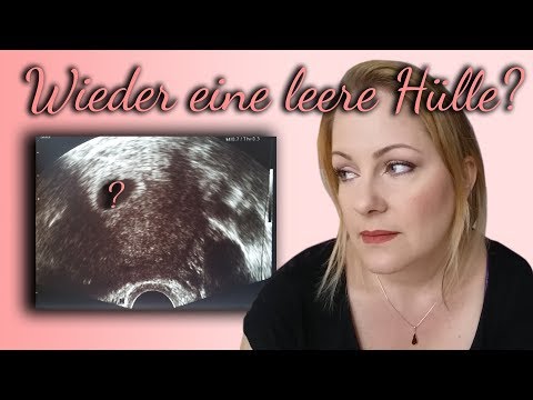 Salbe zur Ellenbogen Schmerzen übt Druck auf den unteren Rücken