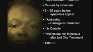 Peter Gabriel - In your Eyes - Leprosy Make a Difference