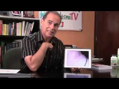 Episodio #533 Verrugas, Obesidad y Diabetes