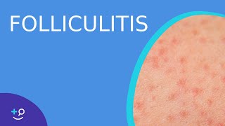 Folliculitis - Daily Do