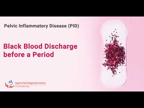 5 Causes of Black Period Blood - Is it alarming?