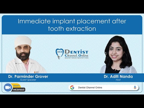 Immediate Implant Placement After Tooth Extraction