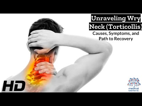 Frozen Shoulder Causes Signs and Symptoms Diagnosis and Treatment