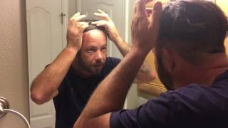 Hair Replacement Hair System Review Cleaning the front hairline Very important