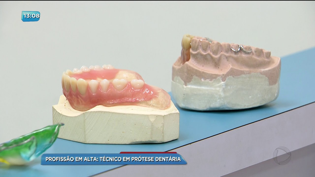 BG - Profissão em alta: Técnico em prótese dentária - 12-03-2018