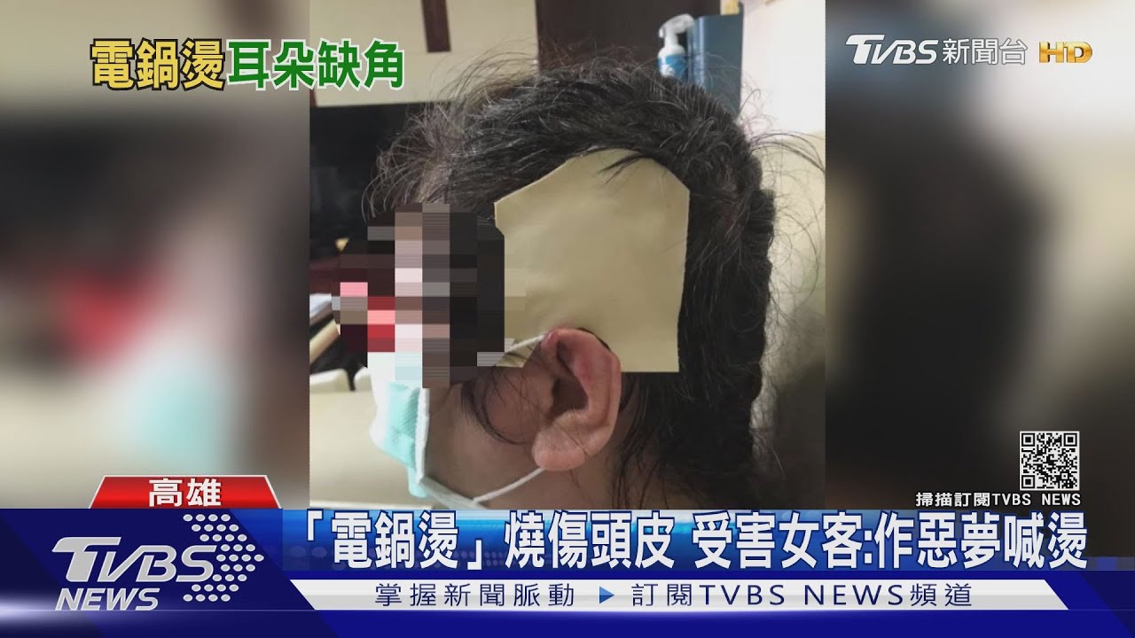 這是蝦米碗割!「電鍋燙」燒傷婦左耳 缺一角清創4次