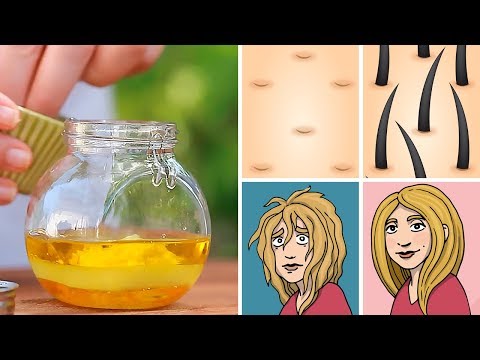 Dass Sie sich auf die Gelenke und Bänder trinken Tendinitis, dass es hip ist