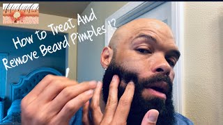 Ingrown Hair vs Beard Pimples / How To Treat and Remove Beard Pimples