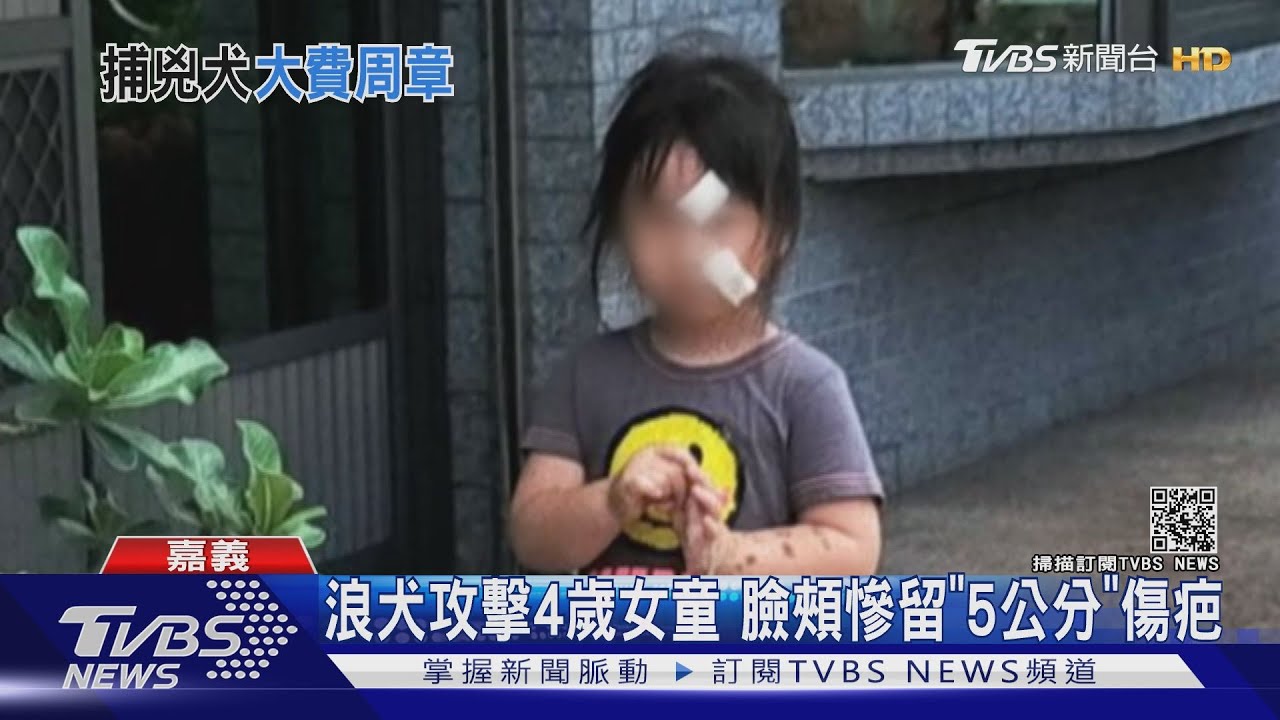 浪犬攻擊4歲女童　臉頰慘留「5公分」傷疤