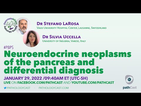 Neuroendocrine neoplasms of the pancreas and differential diagnosis